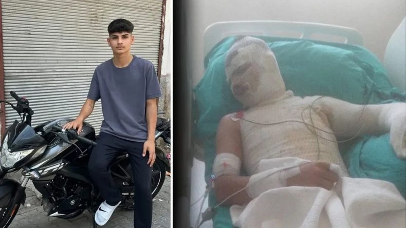 Aile İçinde Şok Edici Olay: Yeğenini Diri Diri Yaktı