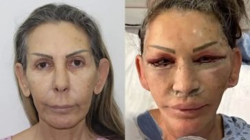 Petek Dinçöz'ün Annesi Estetik Ameliyatı Geçirdi: Son Durumu Şaşırtıyor