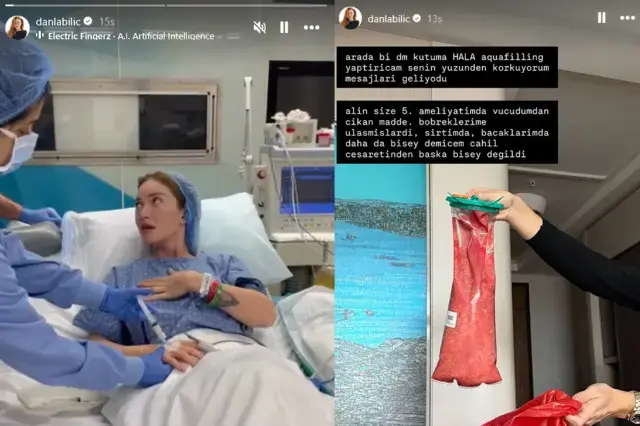 Çıkan Dolgu Maddesi