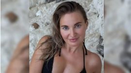 &Uuml;nl&uuml; Sosyal Medya Fenomeninden Acı Haber: Estetik Ameliyatı Sonucu Hayatını Kaybetti