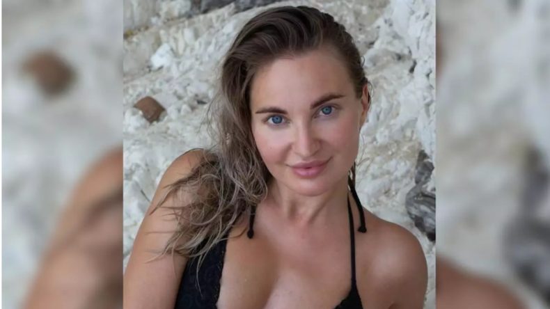 &Uuml;nl&uuml; Sosyal Medya Fenomeninden Acı Haber: Estetik Ameliyatı Sonucu Hayatını Kaybetti